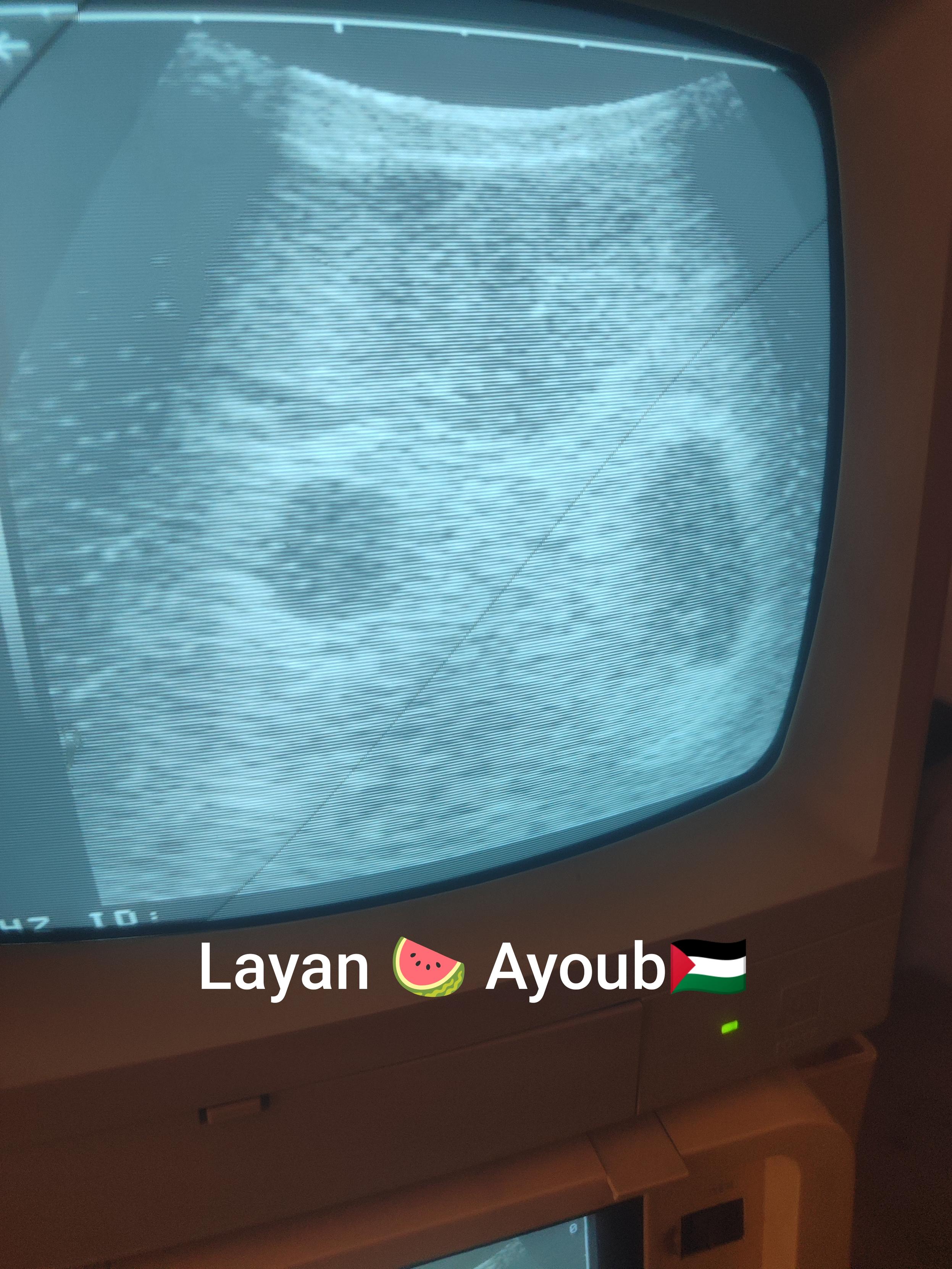 Ma mère et son bébé à naître sont dans un état critique 🚨❤️‍🩹 Après avoir lutté pour accéder aux soins 😔, le bébé a survécu grâce à Dieu, et nous avons un rendez-vous médical important samedi prochain 🙏. Nous avons besoin de 100 $ pour couvrir les examens nécessaires et confirmer le rendez-vous. S'il vous plaît, ne nous laissez pas tomber ; ma mère et son enfant sont entre nos mains 💔🙏 <a href=